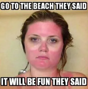 burned face hot weather meme